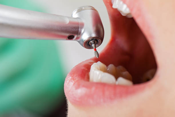 Best Weekend Emergency Dentist in Fletcher, NC